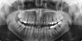 Radiografia Dental