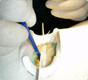 Blanqueamiento Denta